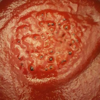 Rezept Ketchup lowcarb zuckerfrei ohne Zucker kalorienarm